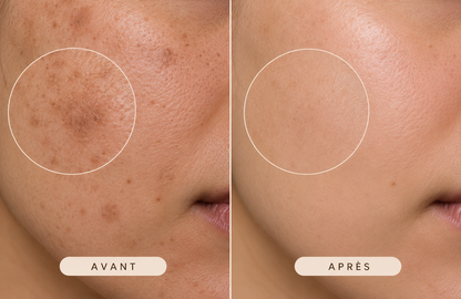 Savon Éclat Anti-Imperfections au Curcuma